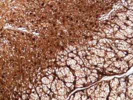 Immunohistochemistry (Formalin/PFA-fixed paraffin-embedded sections) - Anti-S100 beta antibody [SP127] - Astrocyte Marker (AB115803)