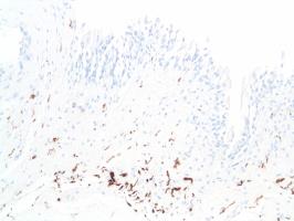 Immunohistochemistry (Formalin/PFA-fixed paraffin-embedded sections) - Anti-S100 beta antibody [SP127] (ab115803), expandable thumbnail