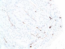 Immunohistochemistry (Formalin/PFA-fixed paraffin-embedded sections) - Anti-S100 beta antibody [SP127] - Astrocyte Marker (ab115803), expandable thumbnail