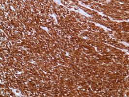 Immunohistochemistry (Formalin/PFA-fixed paraffin-embedded sections) - Anti-S100 beta antibody [SP127] - Astrocyte Marker (ab115803), expandable thumbnail
