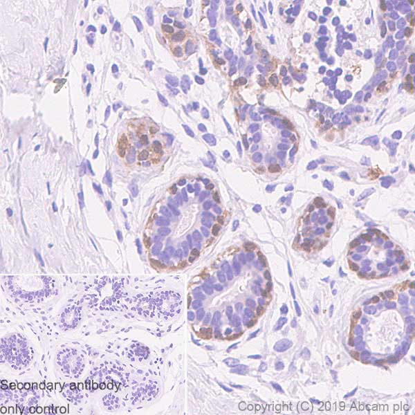 Immunohistochemistry (Formalin/PFA-fixed paraffin-embedded sections) - Anti-S100 beta antibody [SP127] (AB115803), expandable thumbnail