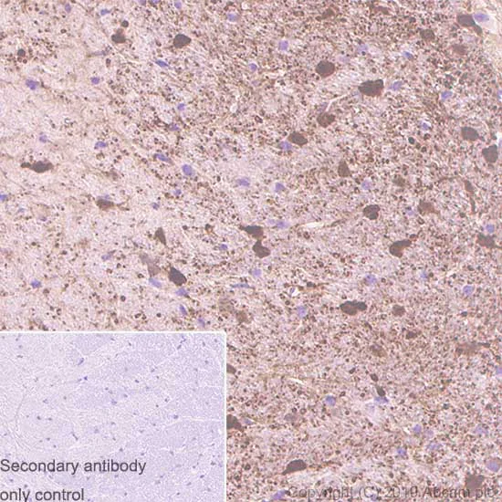 Immunohistochemistry (Formalin/PFA-fixed paraffin-embedded sections) - Anti-S100 beta antibody [SP127] - BSA and Azide free (AB242388)