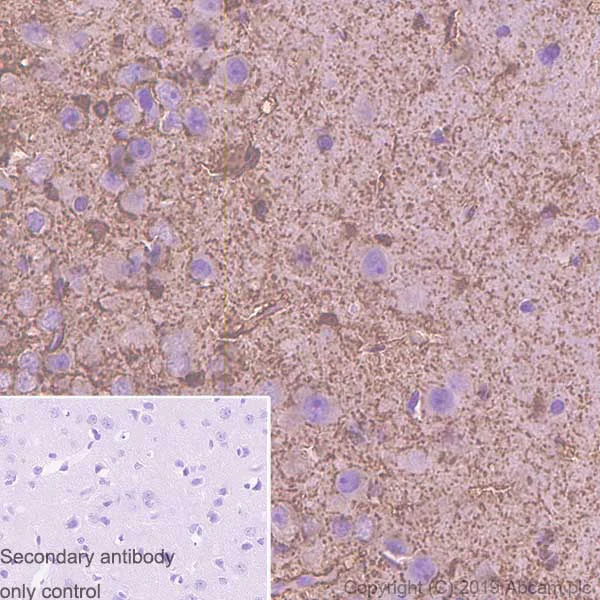 Immunohistochemistry (Formalin/PFA-fixed paraffin-embedded sections) - Anti-S100 beta antibody [SP127] - BSA and Azide free (AB242388)