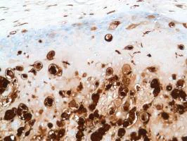 Immunohistochemistry (Formalin/PFA-fixed paraffin-embedded sections) - Anti-S100 beta antibody [SP127] - BSA and Azide free (AB242388)