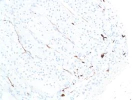 Immunohistochemistry (Formalin/PFA-fixed paraffin-embedded sections) - Anti-S100 beta antibody [SP127] - BSA and Azide free (AB242388)