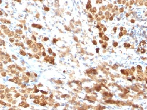 Immunohistochemistry (Formalin/PFA-fixed paraffin-embedded sections) - Anti-S100 beta antibody [SPM354] - Astrocyte Marker (AB218514)