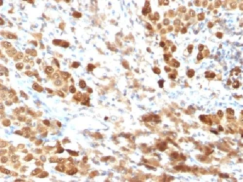 Immunohistochemistry (Formalin/PFA-fixed paraffin-embedded sections) - Anti-S100 beta antibody [SPM354] - Astrocyte Marker (AB218514)