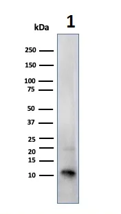 Western blot - Anti-S100 beta antibody [SPM354] - Astrocyte Marker (AB218514)