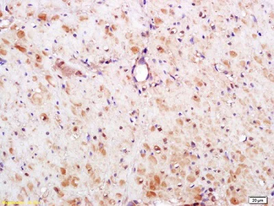 Immunohistochemistry (Formalin/PFA-fixed paraffin-embedded sections) - Anti-S100 Calcium Binding Protein A13/S100A13 antibody (AB214190)