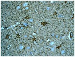 Immunohistochemistry (Formalin/PFA-fixed paraffin-embedded sections) - Anti-S100 Calcium Binding Protein A13/S100A13 antibody [EPR4510] (AB109252)