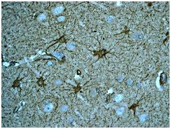 Immunohistochemistry (Formalin/PFA-fixed paraffin-embedded sections) - Anti-S100 Calcium Binding Protein A13/S100A13 antibody [EPR4510] - BSA and Azide free (AB239962), expandable thumbnail