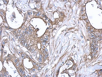 Immunohistochemistry (Formalin/PFA-fixed paraffin-embedded sections) - Anti-S100A10 antibody (AB137658), expandable thumbnail
