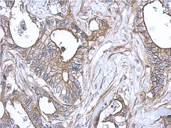 Immunohistochemistry (Formalin/PFA-fixed paraffin-embedded sections) - Anti-S100A10 antibody (AB137658)