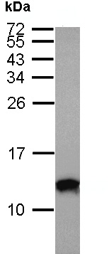 Western blot - Anti-S100A10 antibody (AB137658), expandable thumbnail