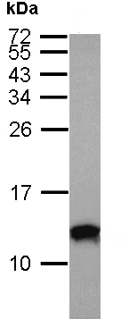 Western blot - Anti-S100A10 antibody (AB137658)