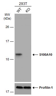 Western blot - Anti-S100A10 antibody (AB137658), expandable thumbnail