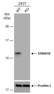 Western blot - Anti-S100A10 antibody (AB137658)