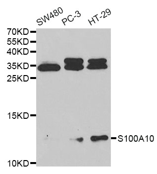 Western blot - Anti-S100A10 antibody (AB187201), expandable thumbnail