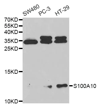 Western blot - Anti-S100A10 antibody (AB187201)