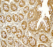Immunohistochemistry (Formalin/PFA-fixed paraffin-embedded sections) - Anti-S100A10 antibody [EPR3317] (ab76472), expandable thumbnail