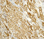 Immunohistochemistry (Formalin/PFA-fixed paraffin-embedded sections) - Anti-S100A10 antibody [EPR3317] (AB76472)