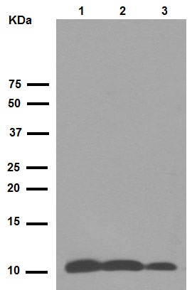 Western blot - Anti-S100A10 antibody [EPR3317] (AB76472), expandable thumbnail