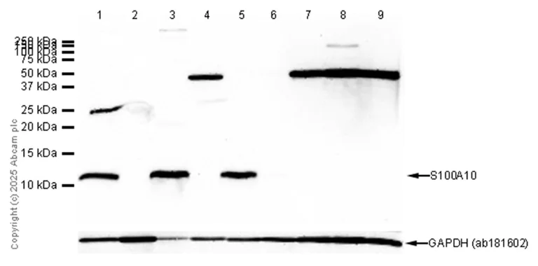 Western blot - Anti-S100A10 antibody [EPR3317] (AB76472)