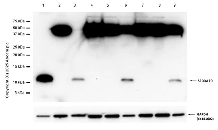Western blot - Anti-S100A10 antibody [EPR3317] (AB76472)