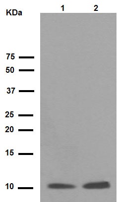 Western blot - Anti-S100A10 antibody [EPR3317] (AB76472), expandable thumbnail
