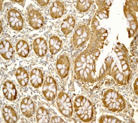 Immunohistochemistry (Formalin/PFA-fixed paraffin-embedded sections) - Anti-S100A10 antibody [EPR3317] - BSA and Azide free (AB232524), expandable thumbnail