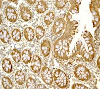 Immunohistochemistry (Formalin/PFA-fixed paraffin-embedded sections) - Anti-S100A10 antibody [EPR3317] - BSA and Azide free (AB232524)