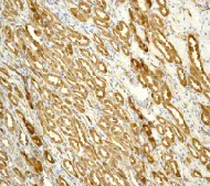 Immunohistochemistry (Formalin/PFA-fixed paraffin-embedded sections) - Anti-S100A10 antibody [EPR3317] - BSA and Azide free (AB232524)
