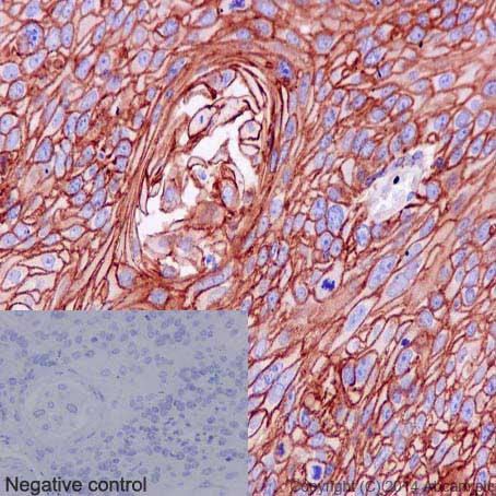 Immunohistochemistry (Formalin/PFA-fixed paraffin-embedded sections) - Anti-S100A10 antibody [EPR3317] - BSA and Azide free (AB232524), expandable thumbnail