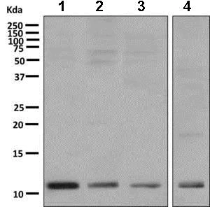 Western blot - Anti-S100A11 antibody [EPR11171(B)] (AB169530)