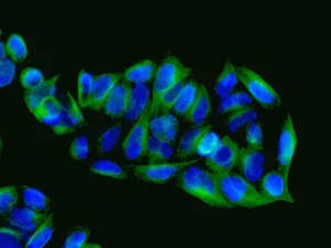 Immunocytochemistry/ Immunofluorescence - Anti-S100A11 antibody [EPR11171(B)] - BSA and Azide free (AB249483)