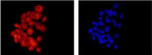 Immunocytochemistry/ Immunofluorescence - Anti-S100A11 antibody [EPR11172] (AB180593), expandable thumbnail