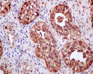 Immunohistochemistry (Formalin/PFA-fixed paraffin-embedded sections) - Anti-S100A11 antibody [EPR11172] (ab180593), expandable thumbnail