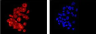 Immunocytochemistry/ Immunofluorescence - Anti-S100A11 antibody [EPR11172] - BSA and Azide free (AB236123)