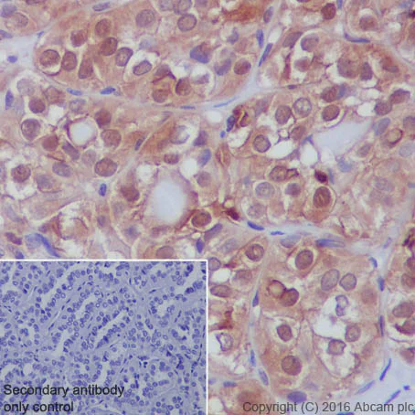 Immunohistochemistry (Formalin/PFA-fixed paraffin-embedded sections) - Anti-S100A11 antibody [EPR11172] - BSA and Azide free (AB236123)