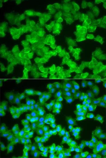 Immunocytochemistry/ Immunofluorescence - Anti-S100A12/CGRP antibody (AB196740)