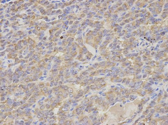 Immunohistochemistry (Formalin/PFA-fixed paraffin-embedded sections) - Anti-S100A12/CGRP antibody (AB196740), expandable thumbnail