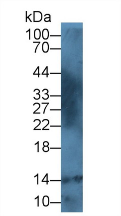 Western blot - Anti-S100A12/CGRP antibody (AB231654)