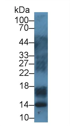Western blot - Anti-S100A12/CGRP antibody (AB231654)
