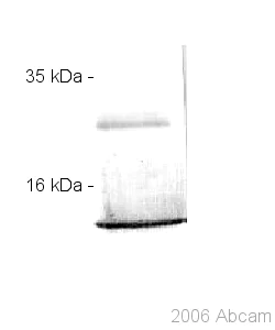 Western blot - Anti-S100A12/CGRP antibody (AB37657)