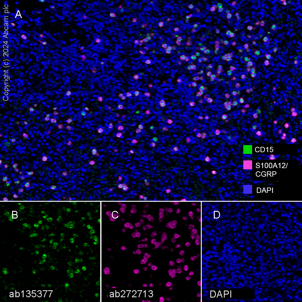 Multiplex immunohistochemistry - Anti-S100A12/CGRP antibody [EPR23677-111] (AB272713)