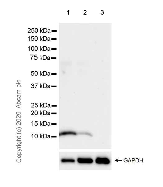 Western blot - Anti-S100A12/CGRP antibody [EPR23677-111] (AB272713)