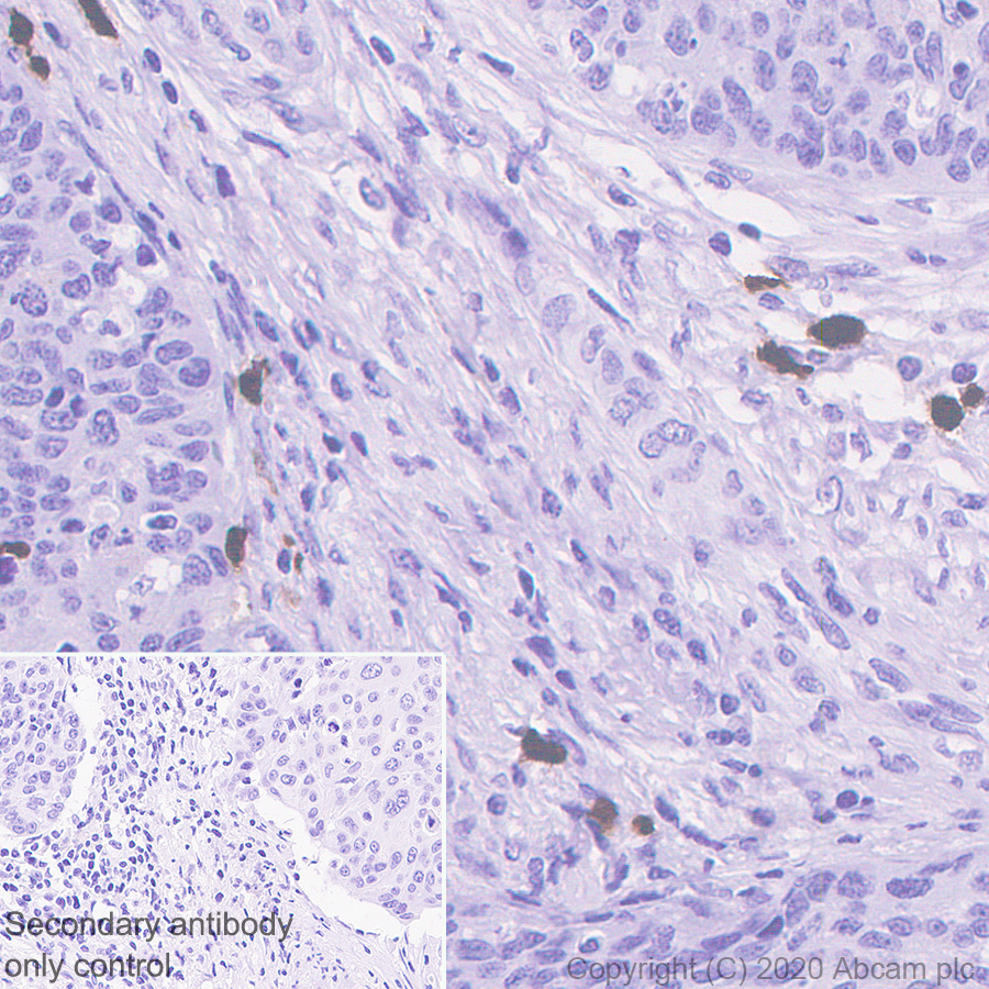 Immunohistochemistry (Formalin/PFA-fixed paraffin-embedded sections) - Anti-S100A12/CGRP antibody [EPR23677-111] - BSA and Azide free (ab273051), expandable thumbnail