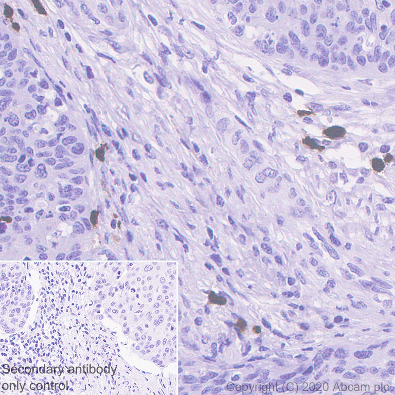 Immunohistochemistry (Formalin/PFA-fixed paraffin-embedded sections) - Anti-S100A12/CGRP antibody [EPR23677-111] - BSA and Azide free (AB273051)