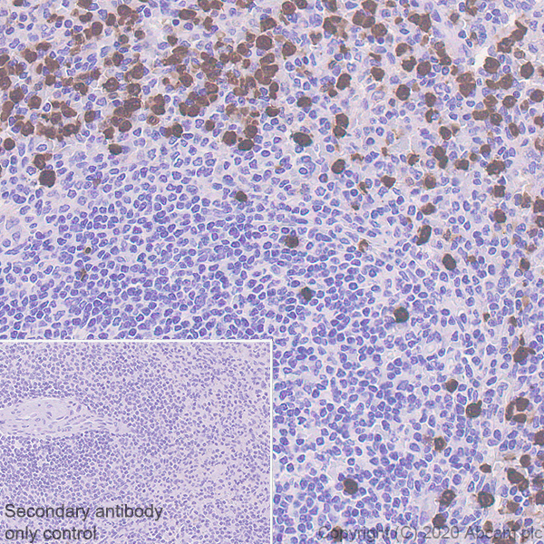 Immunohistochemistry (Formalin/PFA-fixed paraffin-embedded sections) - Anti-S100A12/CGRP antibody [EPR23677-111] - BSA and Azide free (AB273051), expandable thumbnail