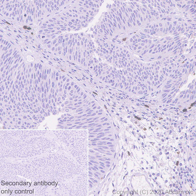 Immunohistochemistry (Formalin/PFA-fixed paraffin-embedded sections) - Anti-S100A12/CGRP antibody [EPR23677-111] - BSA and Azide free (AB273051)